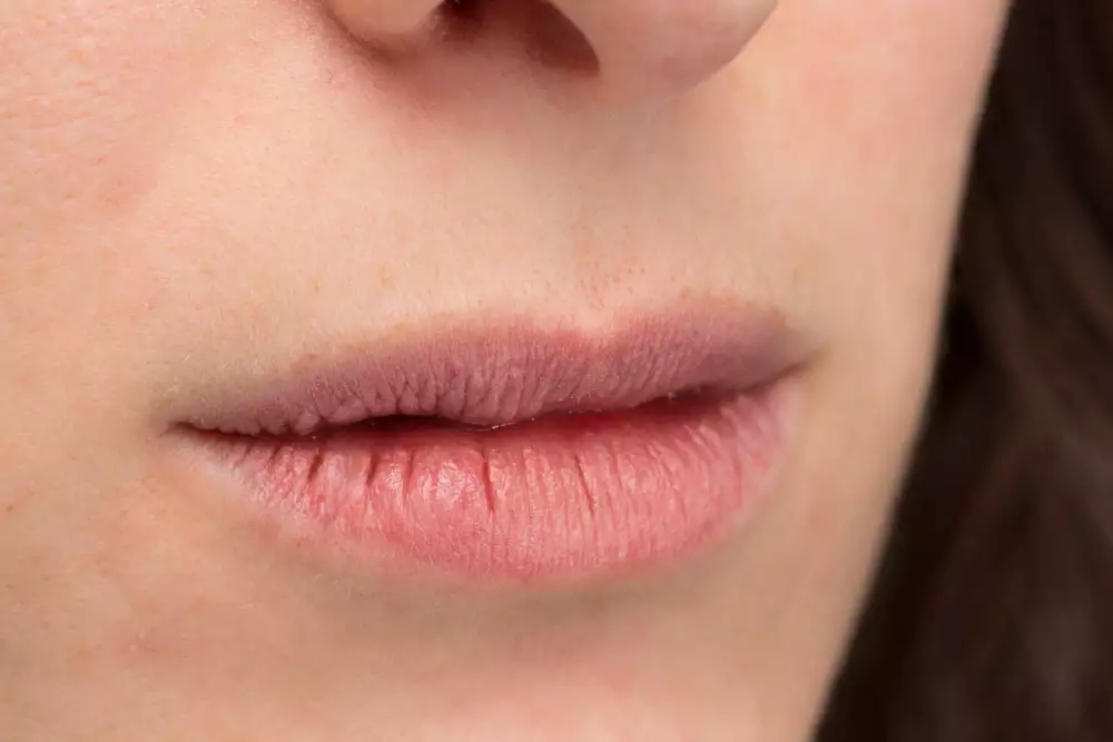 entenda os sintomas da boca seca - Understanding the Causes of Dry Mouth