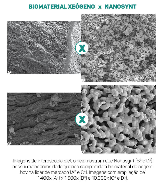 XeogenoXnanosynt 3 - La excelencia en ultraporosidad: Nanosynt