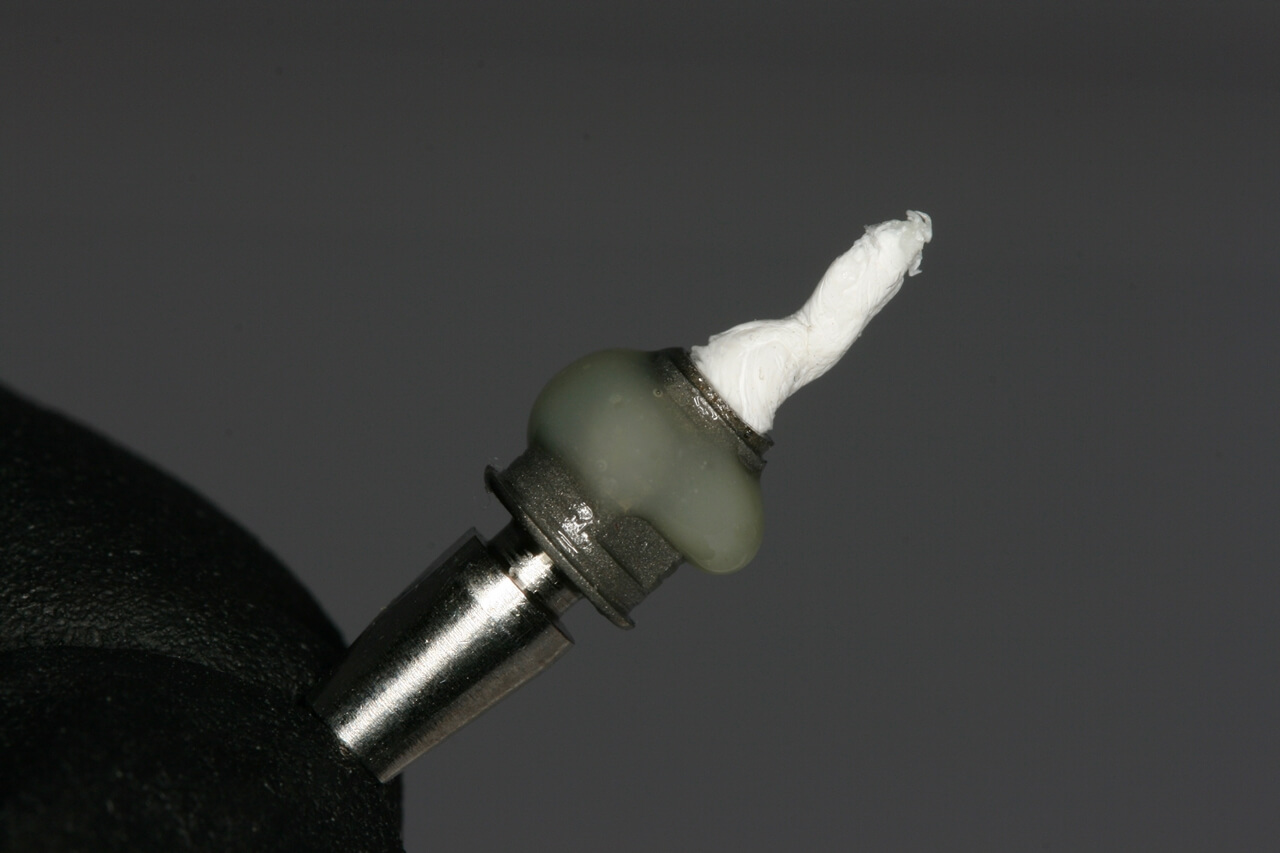 Fig 12 - New tools for rehabilitation on implants, Arcsys and digital workflow