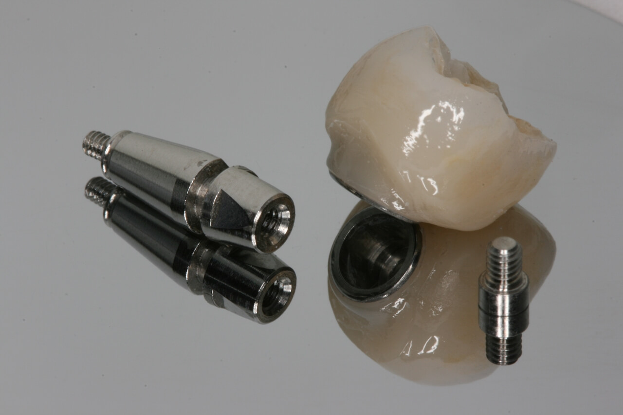 Fig 13 - New tools for rehabilitation on implants, Arcsys and digital workflow