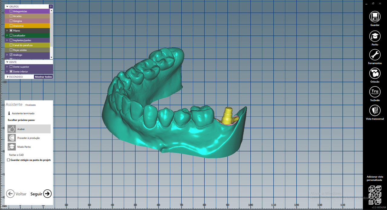 Fig 6a - New tools for rehabilitation on implants, Arcsys and digital workflow