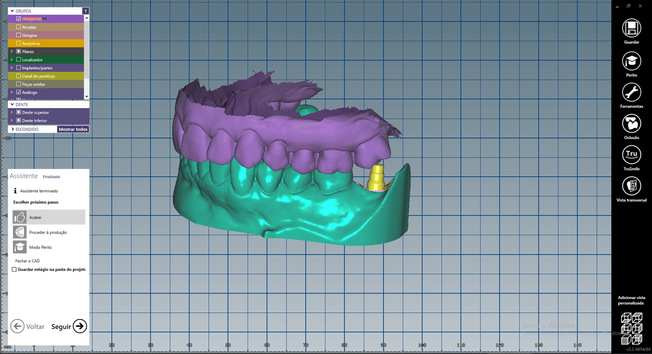 Fig 6b - New tools for rehabilitation on implants, Arcsys and digital workflow