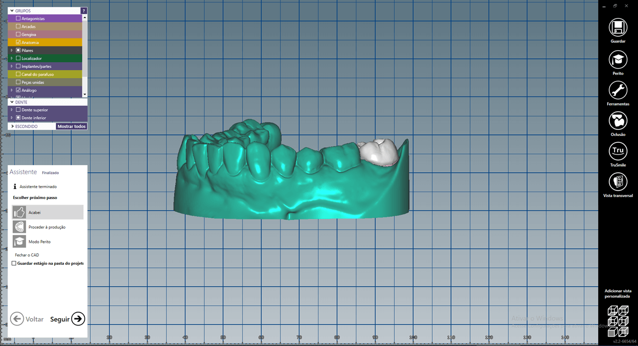 Fig 7 - New tools for rehabilitation on implants, Arcsys and digital workflow