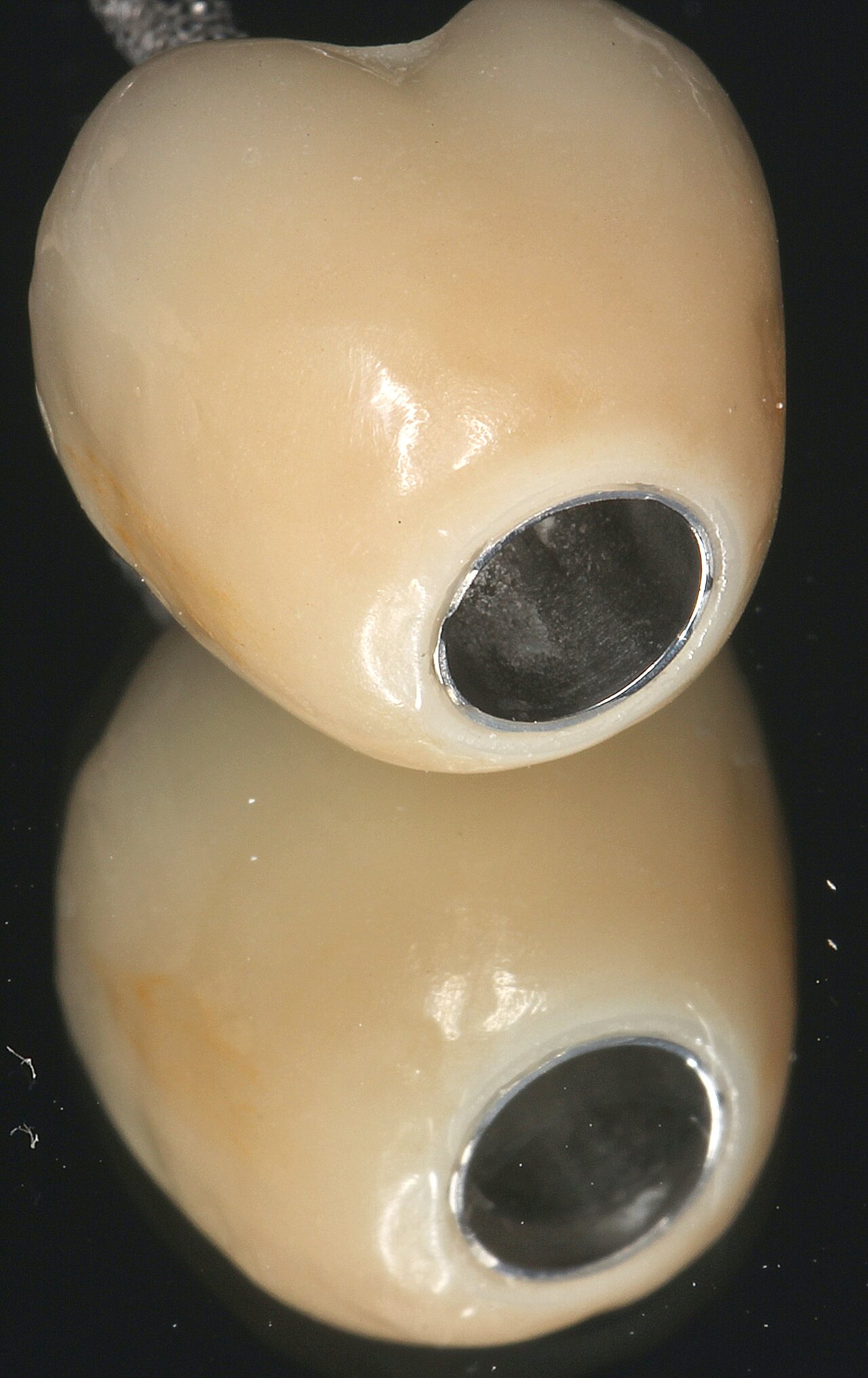 Fig. 22 Término cervical após etapas de acabamento e polimento