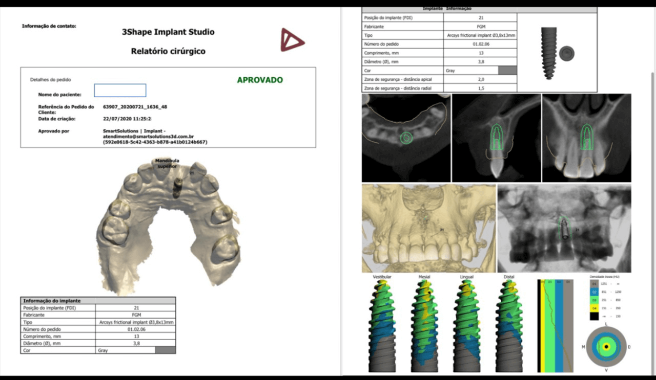 Figura 6 Relatorio cirurgico aprovado - Treatment of a fracture on an upper central incisor with rehabilitation through immediate implant carried out with a virtual surgical guide: a clinical case report