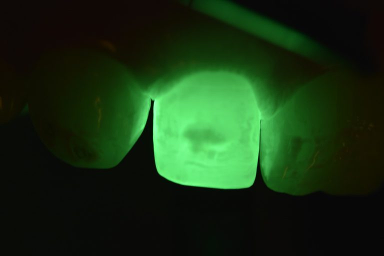 DSC0056 rotated 1 - Blog