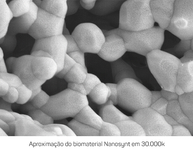 aproximacao - A excelência em ultraporosidade: Enxerto ósseo Nanosynt