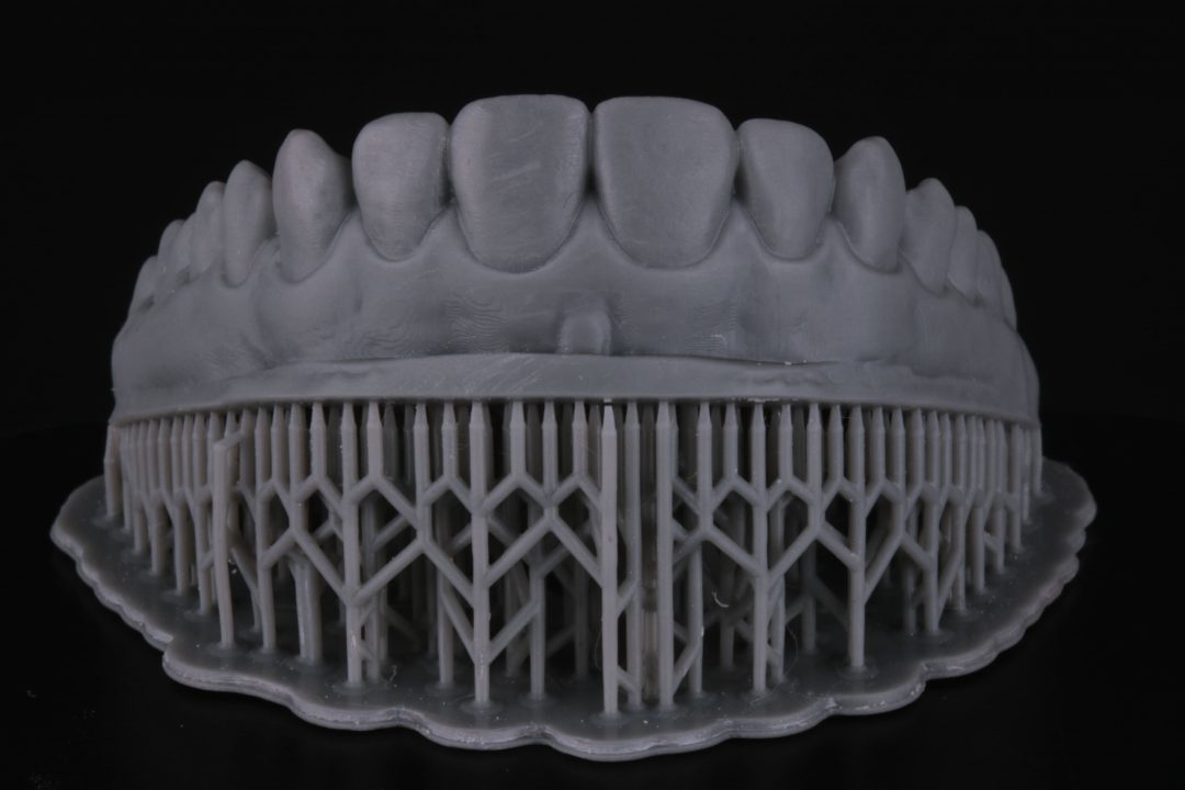 Figs. 5 - Moldagem e modelo impresso do enceramento digital previamente aprovado e guia de silicone para possibilitar a replicação do projeto impresso em boca.