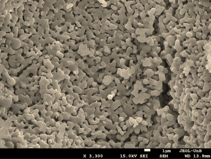 51 2 - Biomaterial granule surrounded by autologous fibrin matrix (L-PRF)