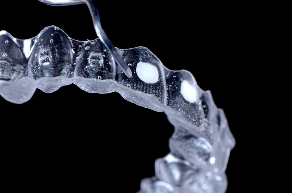Fig. 7 Preenchimento dos slots com a resina Vittra APS Unique FGM no template ap1 - Application of Vittra APS Unique as an esthetic alternative for making attachments for orthodontic aligners