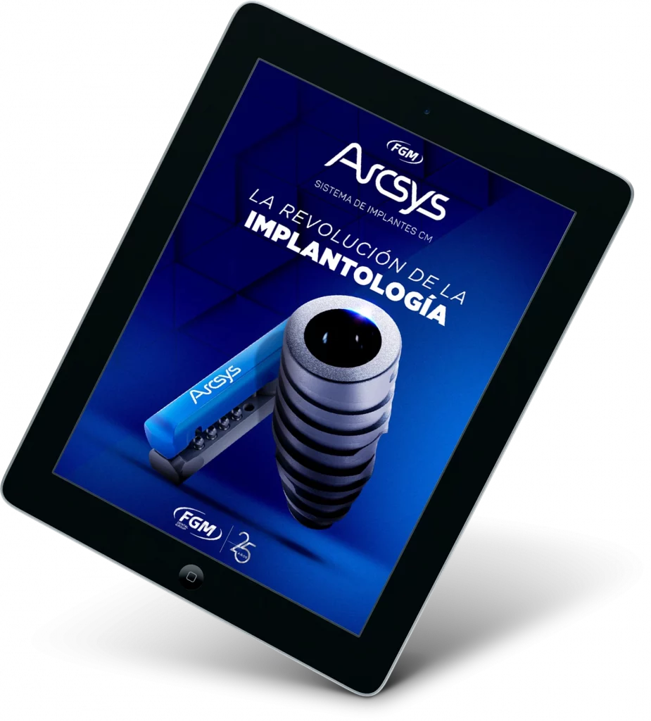 arcsys - E-books Implantes