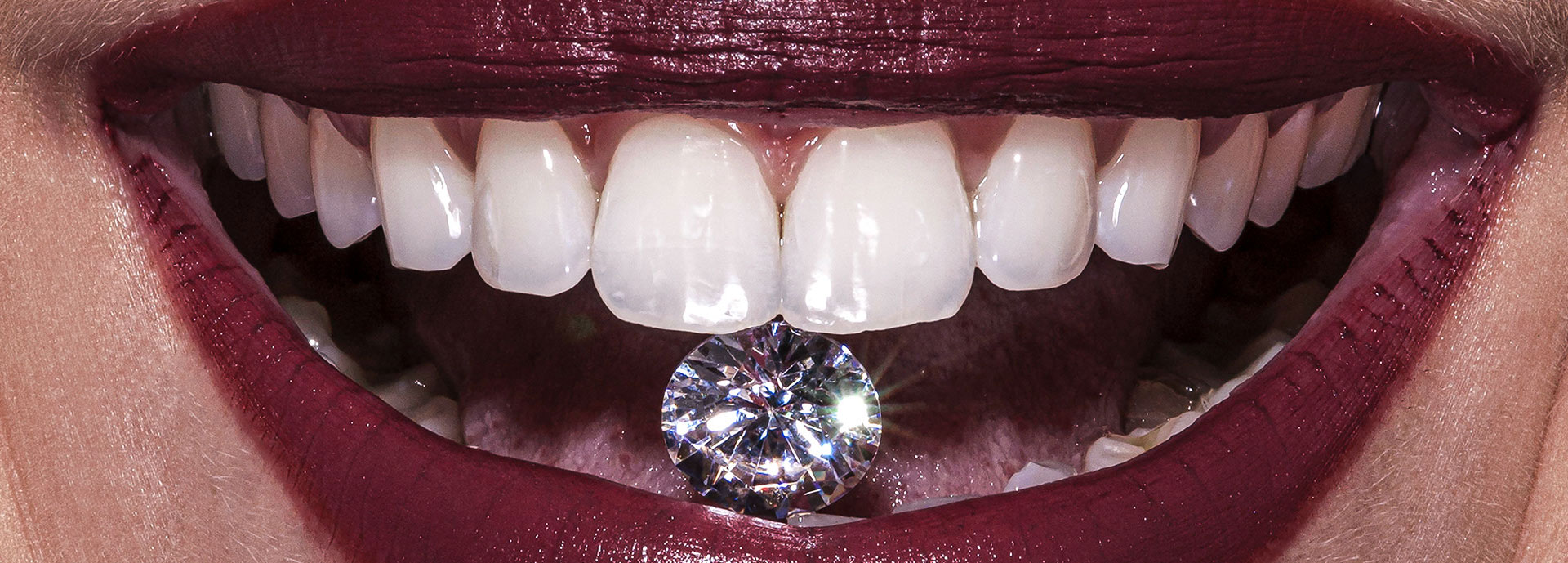 boca whiteness - Fotografia na odontologia: uma forma inovadora de potencializar seu trabalho