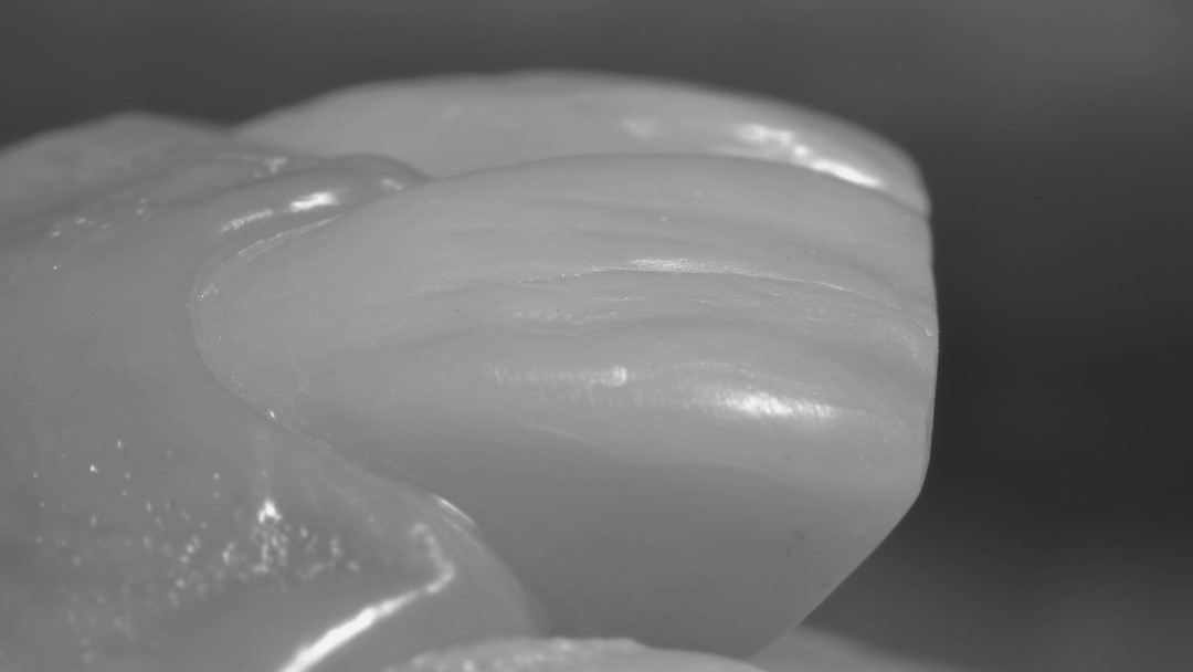 Fig. 22 Imagem em preto e branco onde é possível observar a textura da superfície vestibular. 