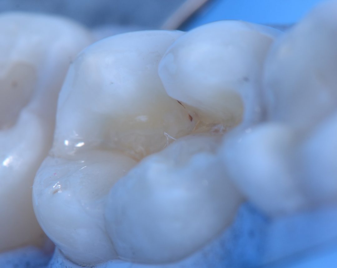 Fig. 7b – Photoactivation. 