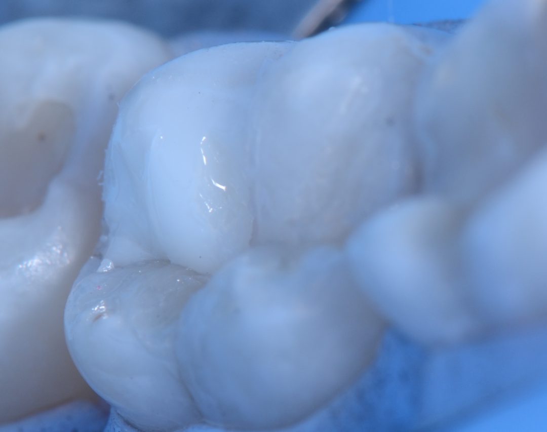 Fig. 8b – Photoactivation. 