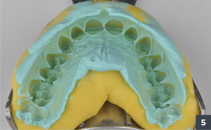 05 - Allcem Veneer - Cemento