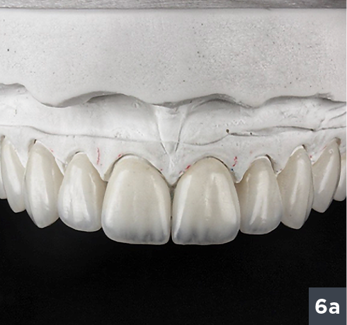 06 - Allcem Veneer - Cemento