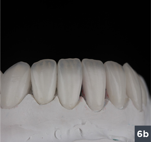 07 - Allcem Veneer - Cemento