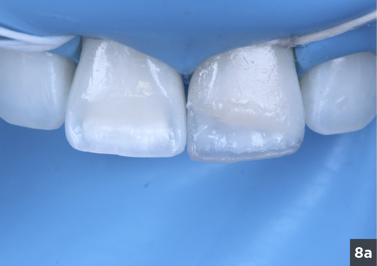 10 corpo DA0 e DA1 - Vittra APS - Estetica Premium