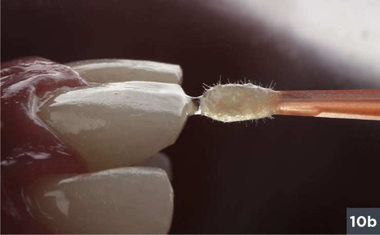 13 - Allcem Veneer - Cemento