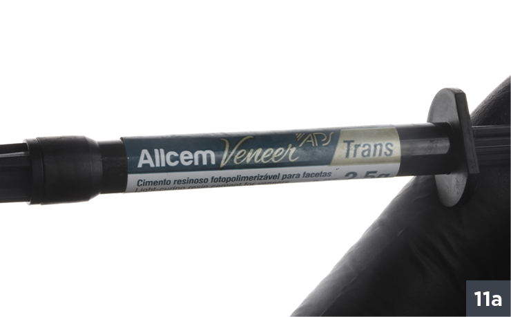 14 - Allcem Veneer - Cemento