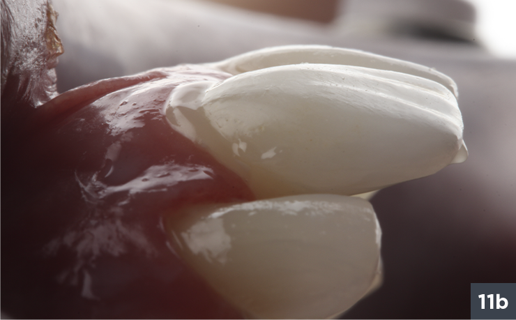 15 - Allcem Veneer - Cemento