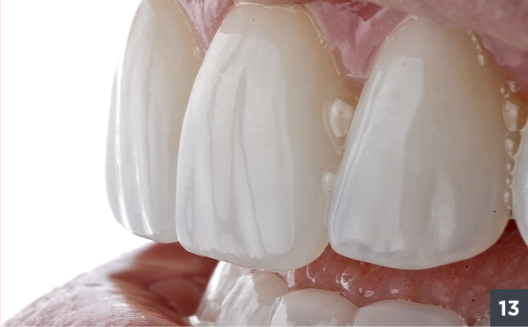 17 - Allcem Veneer - Cemento