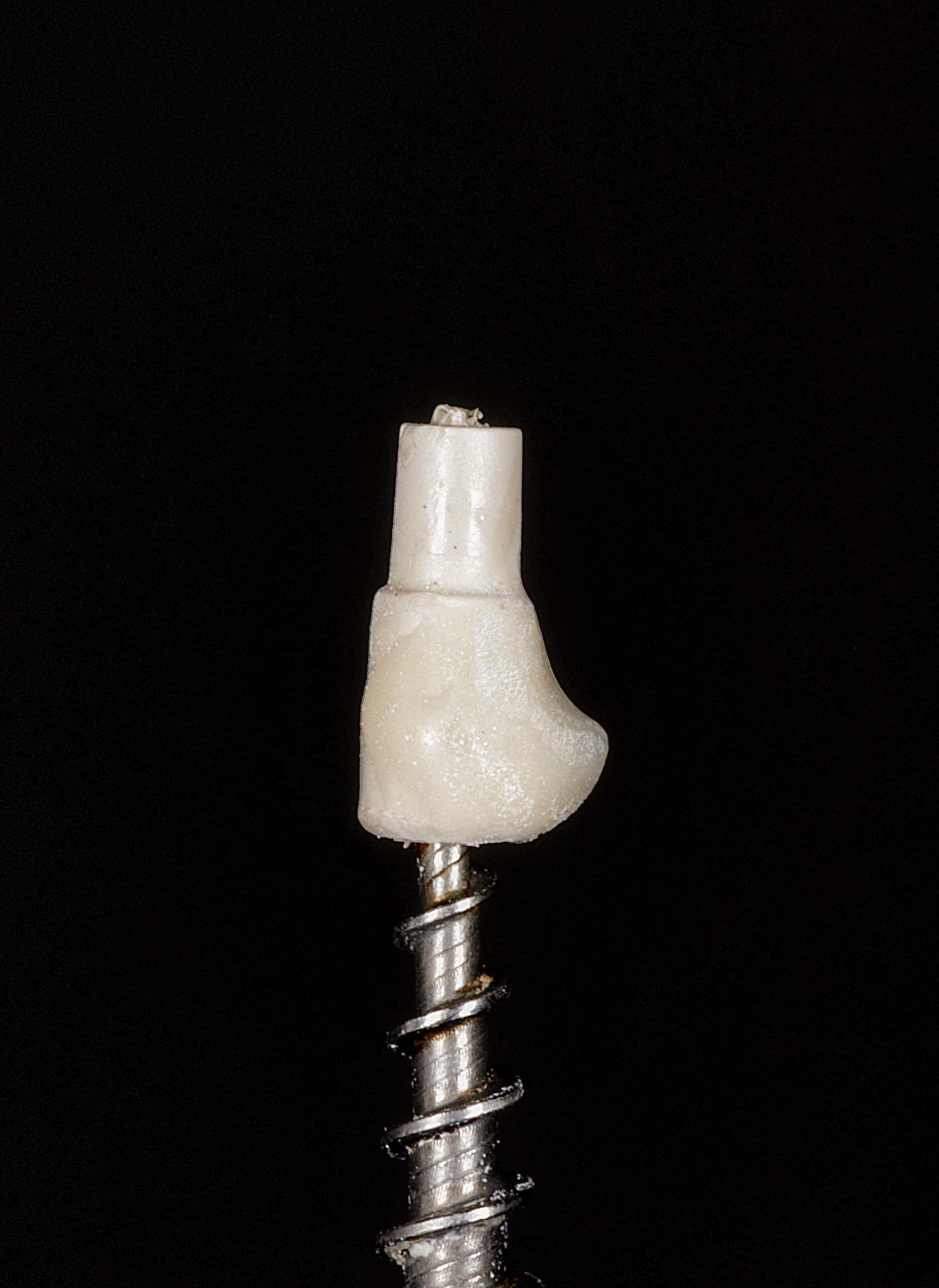 fig 12 scaled - Implante Tardio com Manipulação Imediata e Uso de Cicatrizador Arcsys de Tecido Mole