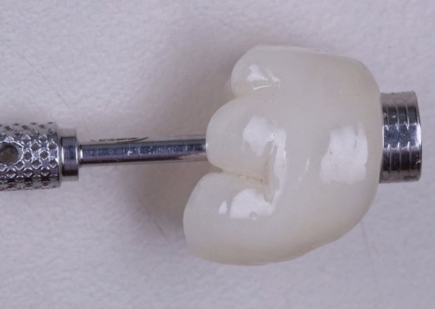 image18 e1705673531189 - Implante Imediato Arcsys em molar inferior