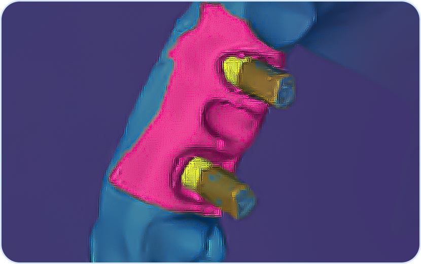 04 Arquivos digitais em formato STL - Digital Workflow