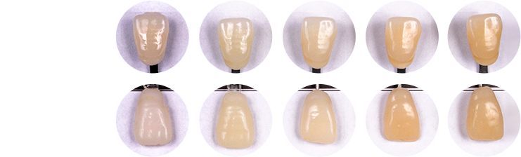 Escala Vita PT - PrimmaArt - Confecção de provisórios