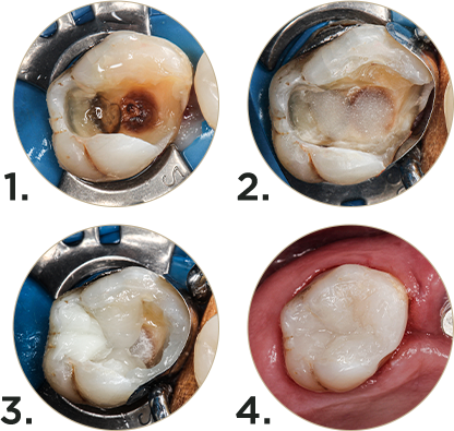 podre.png - Vittra APS Unique - Il vero effetto camaleonte