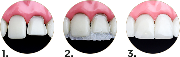 resina 3.png - Vittra APS Unique - Il vero effetto camaleonte