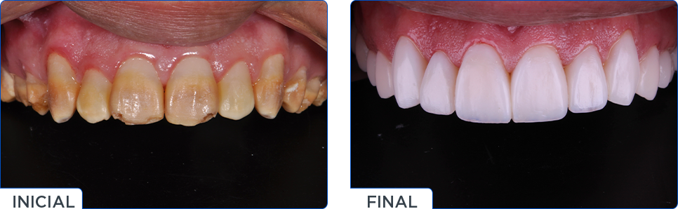 CASO CLINICO - FGM e você na IDS