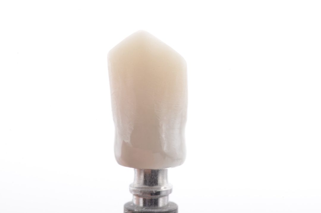 Fig. 16 - Vista frontal da infraestrutura usinada