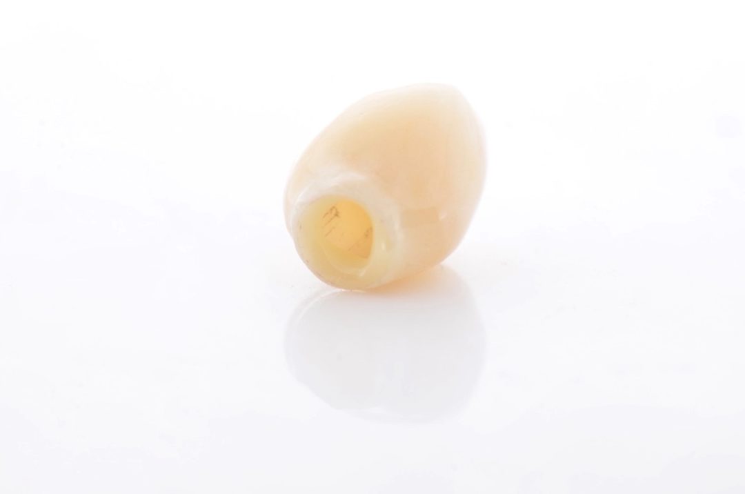 Fig. 20 - Após limpeza, aplique o cimento resinoso na borda interna da peça