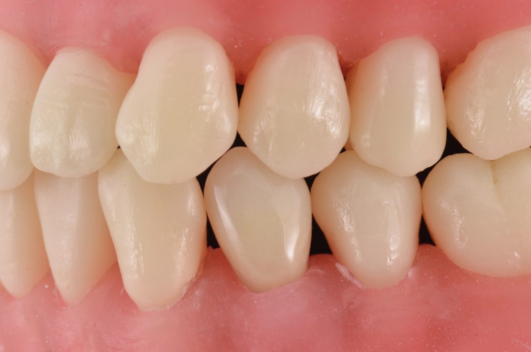 Fig. 22 - Conclusão do caso