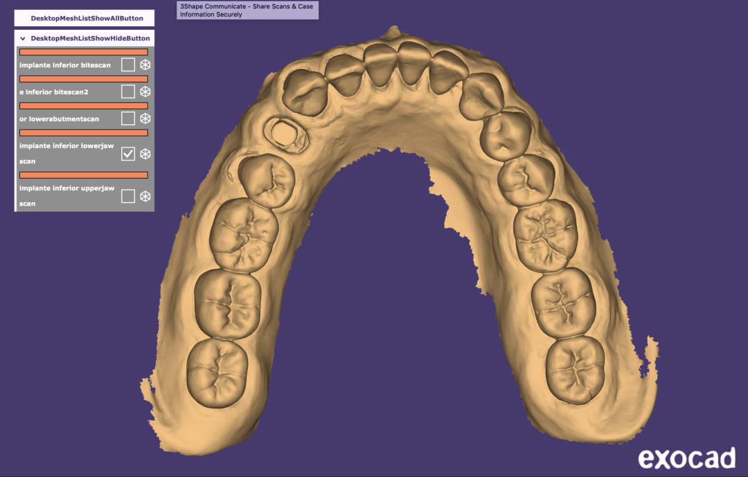 Fig. 5 - Realize o escaneamento inicialmente sem o Scanbody, visando capturar com precisão o condicionamento tecidual obtido