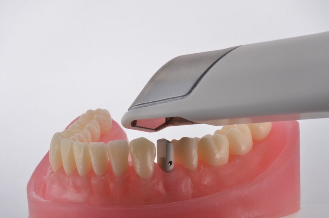 Fig. 7 - Realize o escaneamento com o Scan body, visando capturar com precisão o posicionamento do componente