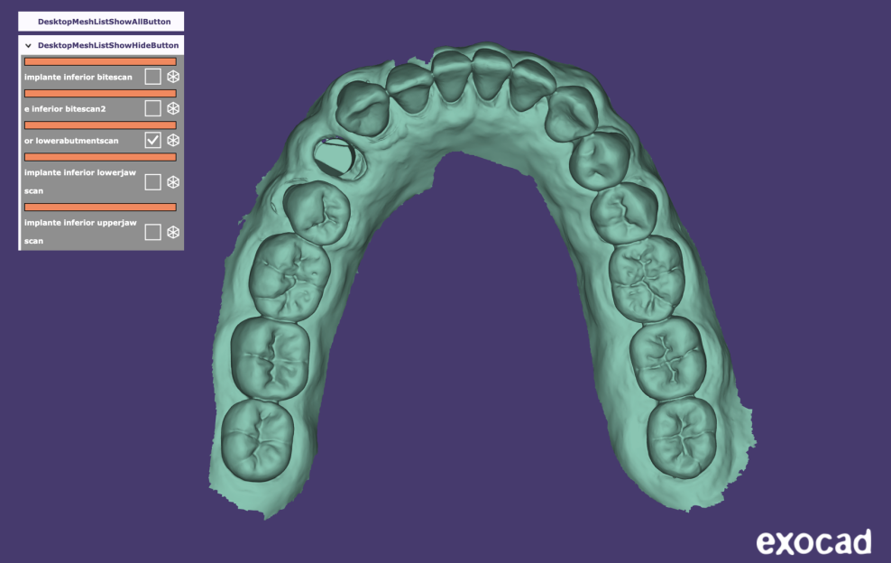 Fig. 8 - Realize o escaneamento com o Scan body, visando capturar com precisão o posicionamento do componente