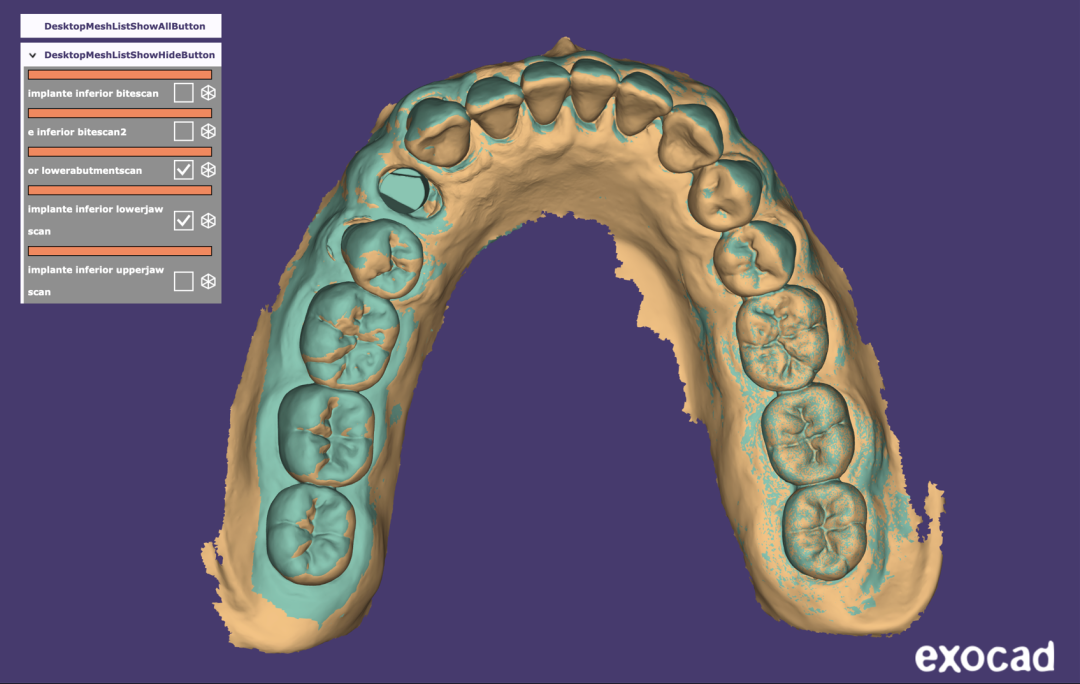 Fig. 9 - Realize o escaneamento com o Scan body, visando capturar com precisão o posicionamento do componente