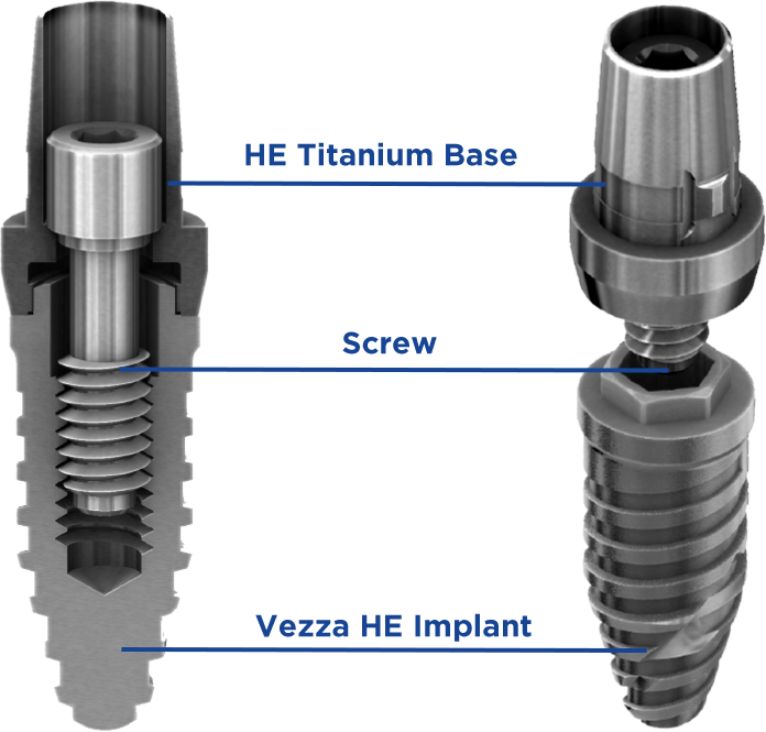 base de titanio 2-EN