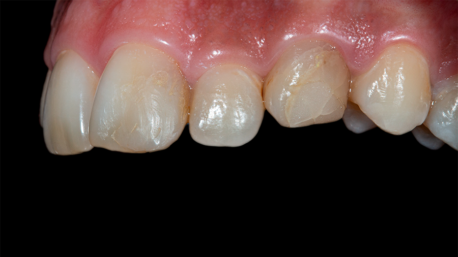 01 - Linha Endodontia