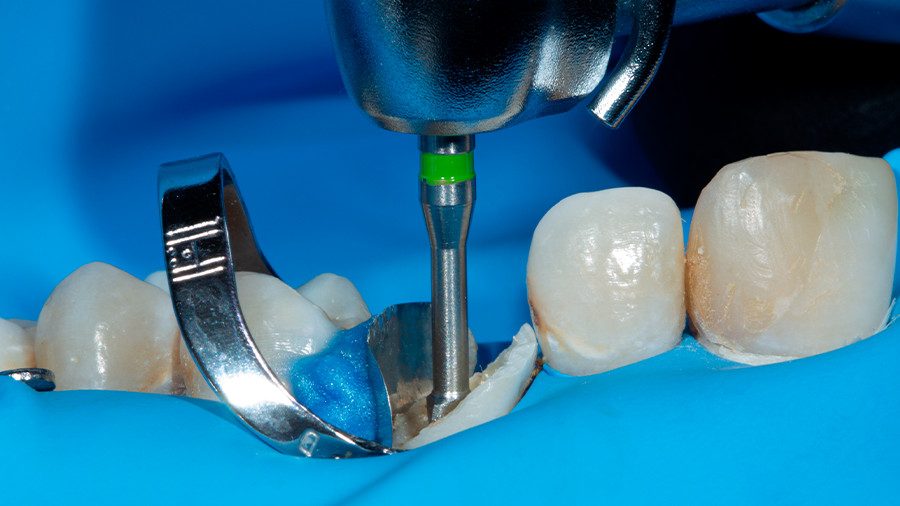 06 - Linha Endodontia