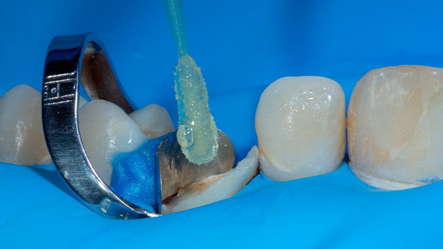 16 - Linha Endodontia