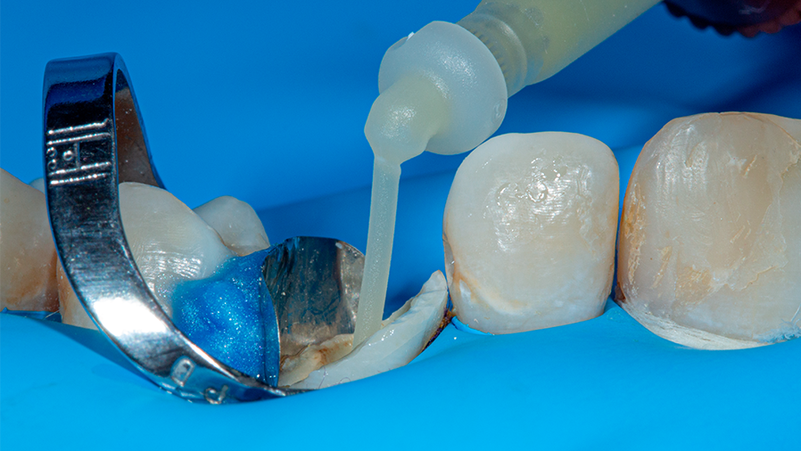 19 - Linha Endodontia