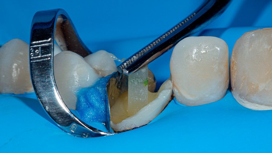20 - Linha Endodontia