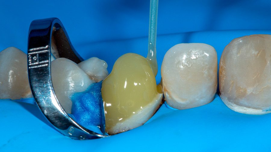 21 - Linha Endodontia