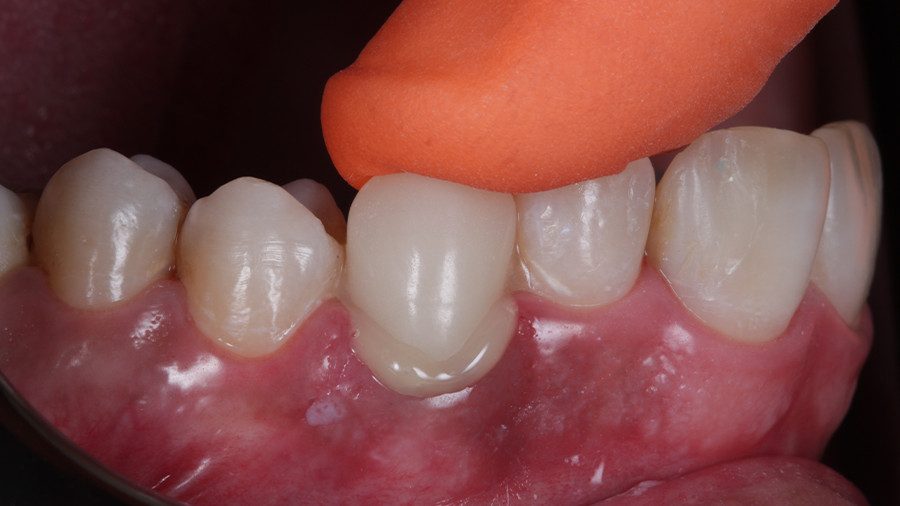 32 - Linha Endodontia
