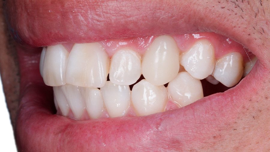 35 - Linha Endodontia